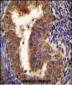 NIX Antibody (Center)