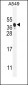 NIX Antibody (Center)