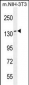 NUP160 Antibody (Center)