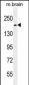 RB1CC1 Antibody (Center)