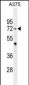 TRIM56  Antibody (C-term)