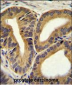 TRIM65  Antibody (Center)