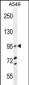 TRIM9  Antibody (C-term)