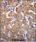 ANKRD58 Antibody (C-term)