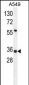ANKRD58 Antibody (C-term)