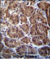 SOCS4 Antibody (Center)