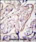 PYCR2 Antibody (Center)