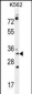 PYCR2 Antibody (Center)