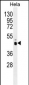 PRKAG1 Antibody (N-term)