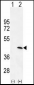 PRKAG1 Antibody (N-term)