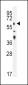 TGFBR2 Antibody (N-term)