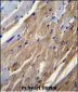 FGF16 Antibody (N-term)