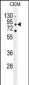 CLCN7 Antibody (C-term)