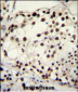TRIM28 Antibody (N-term)