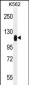 TRIM28 Antibody (N-term)