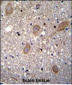 BTRC Antibody (N-term)