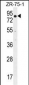 BTRC Antibody (N-term)