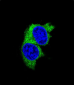 MMP1 Antibody (Center)