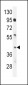 IRF9 Antibody (N-term)