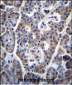 TP53INP1 Antibody (C-term)