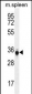 TP53INP1 Antibody (C-term)