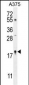 SNR27 Antibody  (Center)