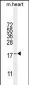 SNR27 Antibody  (Center)