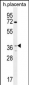 OR2AT4 Antibody (C-term)