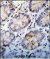 C1QC Antibody (Center)