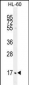 C1QC Antibody (Center)