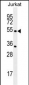 CHRNA2 Antibody (N-term)