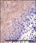 GCLC Antibody (N-term)