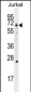 GCLC Antibody (N-term)