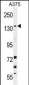 JMJD2B Antibody (N-term)