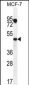 VEGF3 Antibody (N-term)