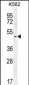 TBX6 Antibody (C-term)