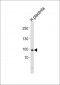 XRCC5 Antibody (Center K439)