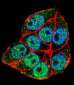 TRADD Antibody (Center)