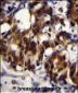 TRADD Antibody (Center)