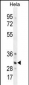 TRADD Antibody (Center)