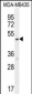 MeCP2 Antibody (N-term S80)