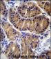 IL17B Antibody (Center)