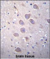 PCDHA5 Antibody (Center)