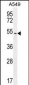 ARRB1 Antibody (C-term)