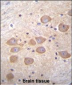 PCDH1 Antibody (N-term)