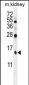 TBCA Antibody (Center)