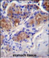 CASP12 Antibody (Center)