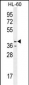 CASP12 Antibody (Center)