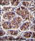 GDF5 Antibody (C-term)