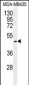 GDF5 Antibody (C-term)